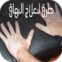 علاج سريع للبهاق طبيعيا